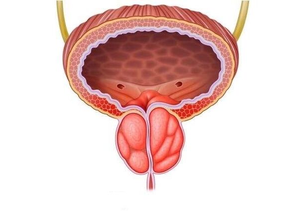 inflamația prostatei la bărbați