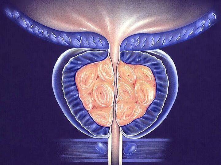 sistem