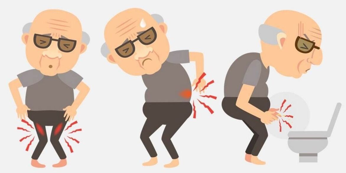 simptome de prostatită